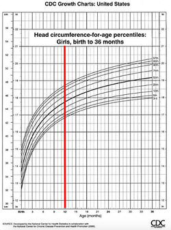 head circumference 